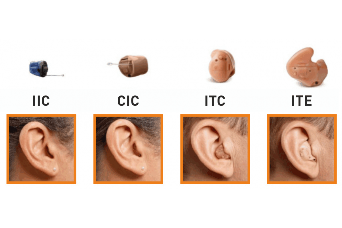 Слуховой аппарат внутриушной невидимый. Цифровой слуховой аппарат внутриушной. Внутриушные слуховые аппараты (ite). Внутриканальные слуховые аппараты(ITC).